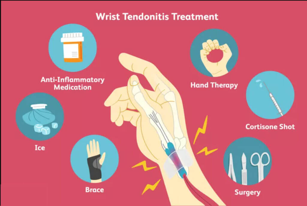 Θεραπεία τενοντίτιδας καρπού 